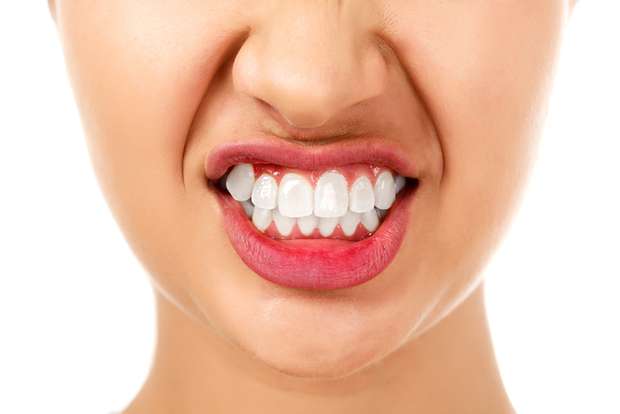 Mordida cruzada pode causar bruxismo e perda dos dentes
